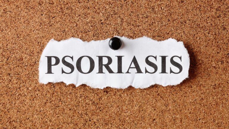 Psoriasis causes, triggers and the skincare routine that actually makes living with it more manageable than you think.