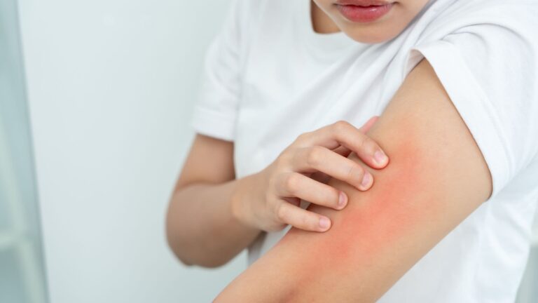 skin wont stop itching